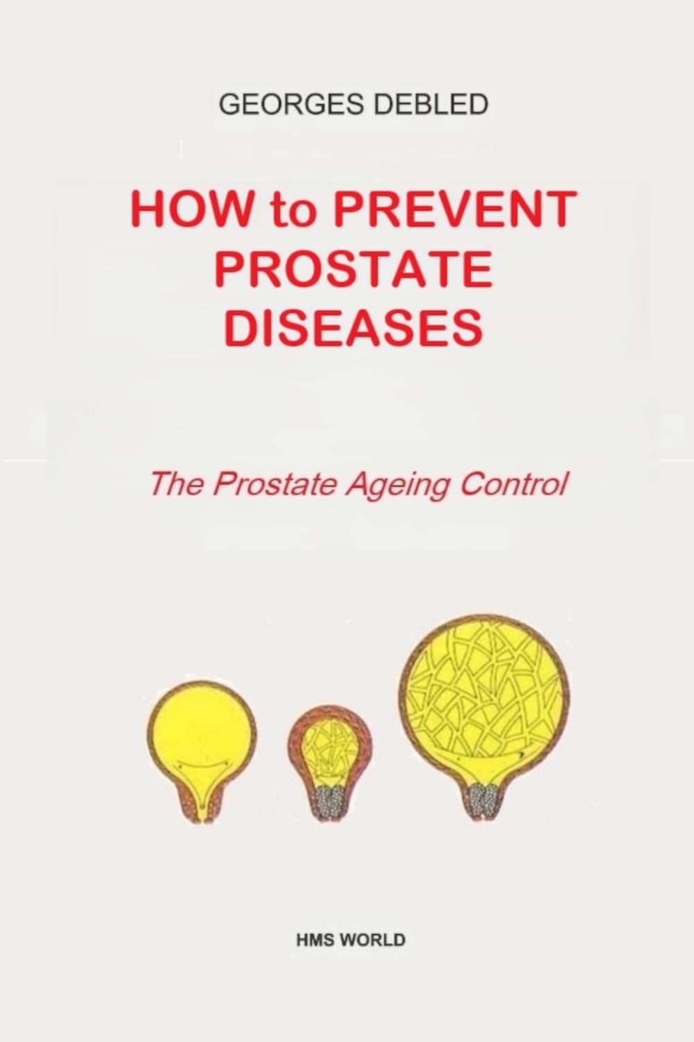 PROSTATE PREVENT